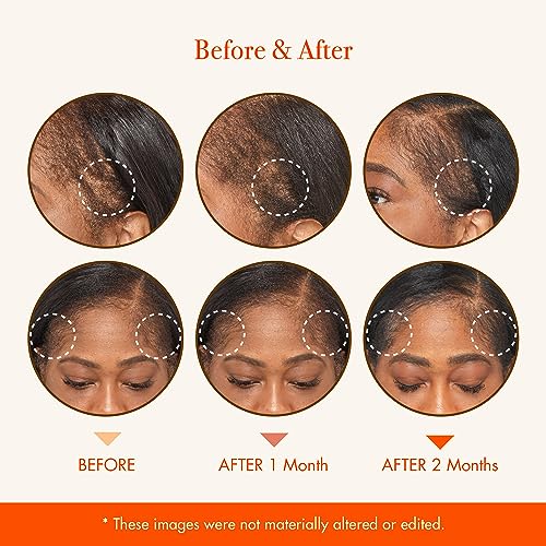 KISS Hair Oil Hair Strengthening Oil Made 4.5Oz - Image 4